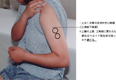 �Q�l�@�a�b�f�̐ڎ�̈ʒu�̐}